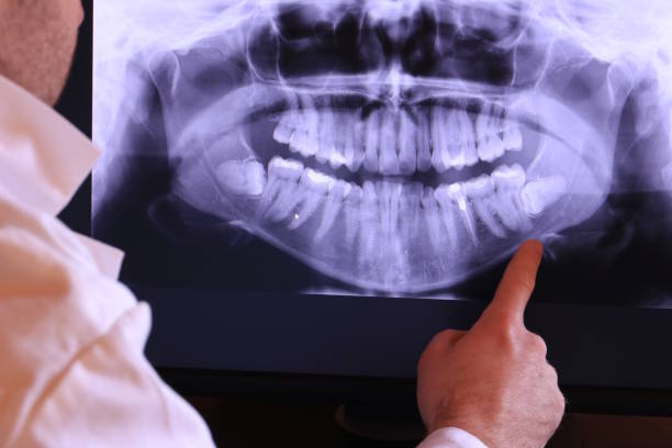 Best Emergency Dental Care for Trauma or Injury in Watford City, ND