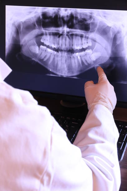 Trusted ND Emergency Dentist Experts