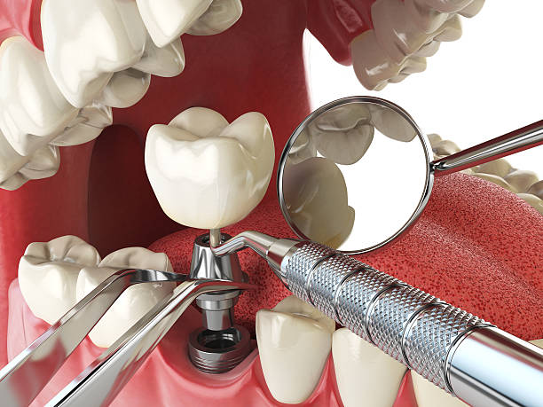 Best Walk-In Emergency Dentist in Watford City, ND